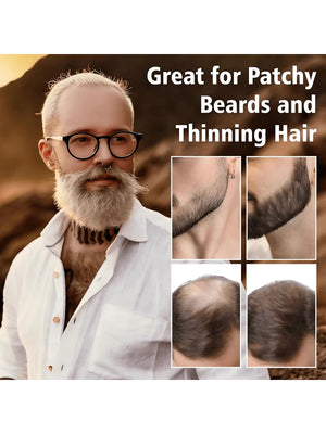 //img.ltwebstatic.com/v4/p/spmp/2025/03/22/b3/17426141918ba2d93d94ada004a52692210d1ec2f8_square_thumbnail_900x.webp